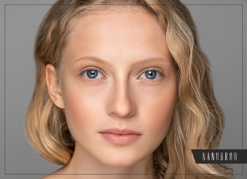 Kaip padidinti antakių apimtis?